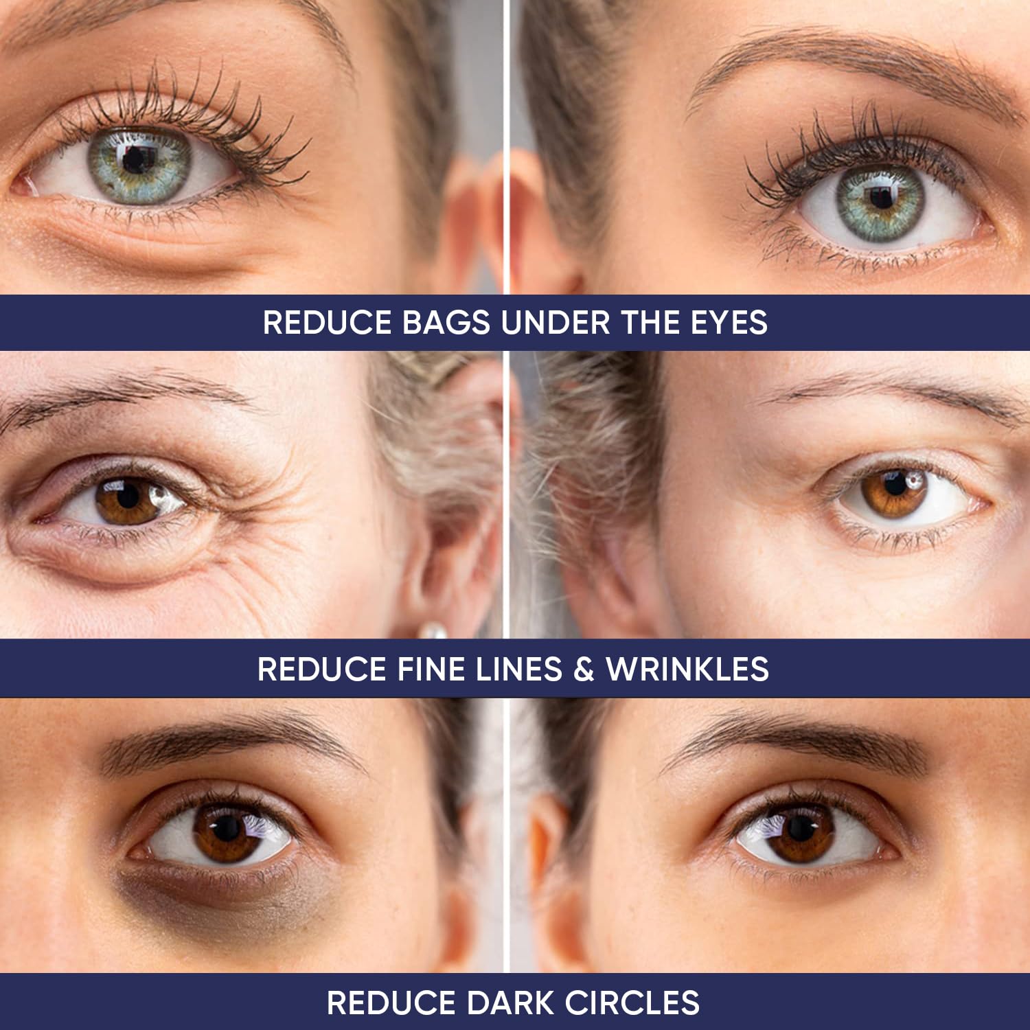 Instant Ageless Eye Cream – Anti Wrinkle Cream, Removes...